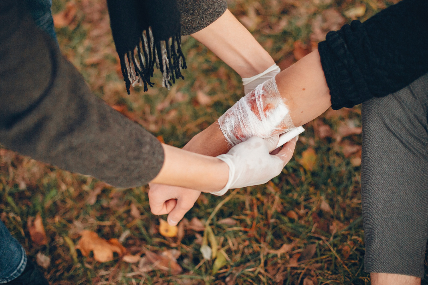 Legal Factors Behind Home Burn Injuries in California