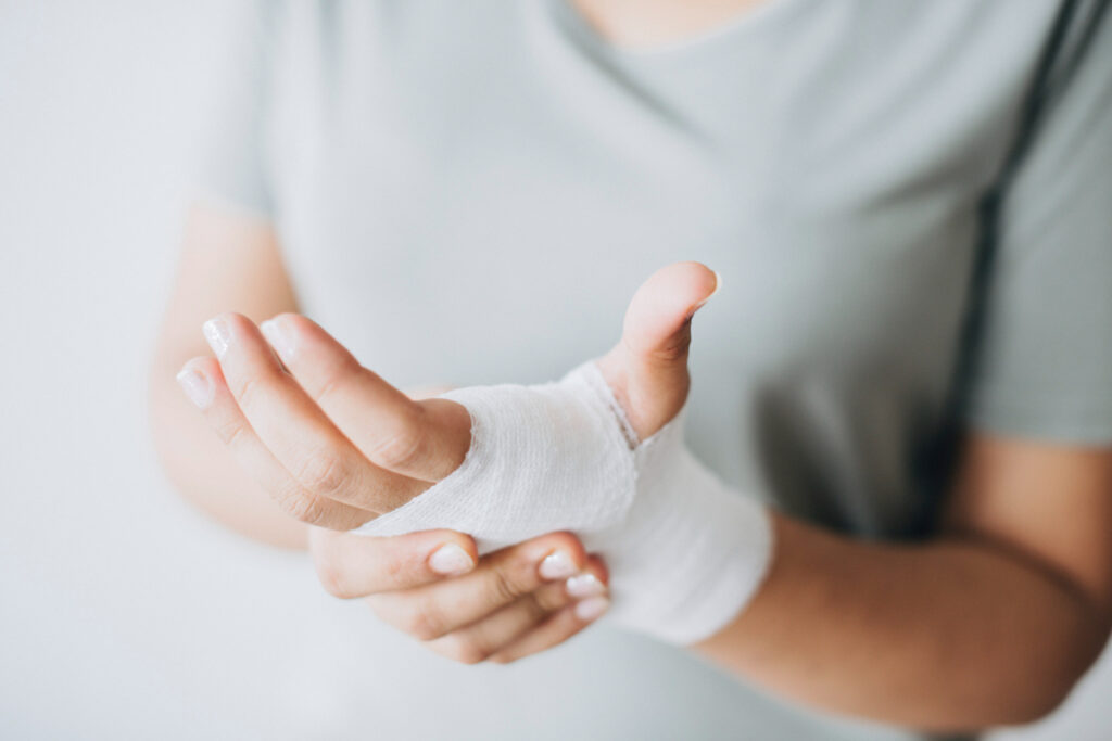 burn injury