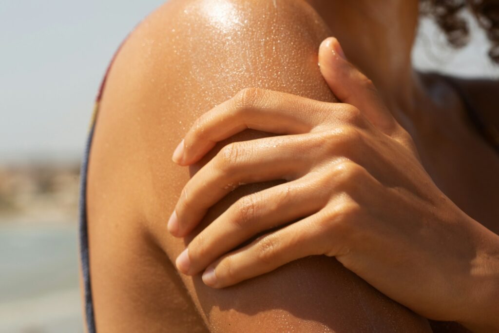 Burn Injuries